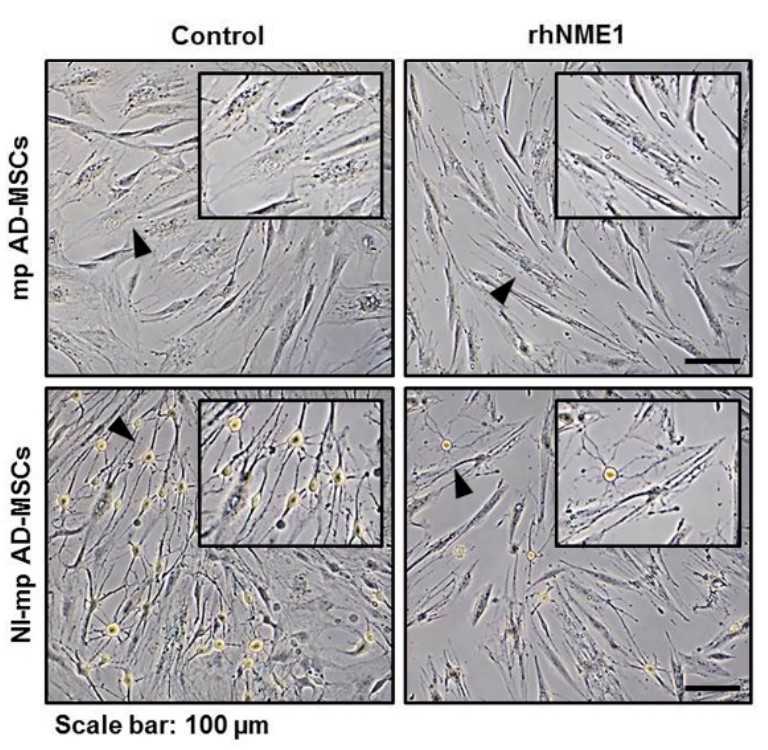 Phase-contrast images of cultured mp AD-MSCs and NI-mp AD-MSCs with or without rhNME1.jpg